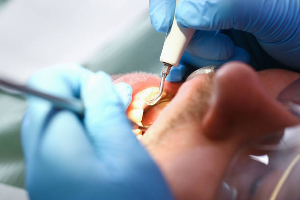 Best Pediatric Emergency Dentist in Warsaw, IN