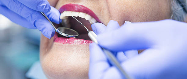 Best Urgent Care for Lost Fillings or Crowns in Warsaw, IN